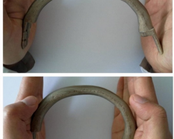 鈦合金將成過去式！我國(guó)實(shí)施國(guó)際首例3D打印PEEK肋骨植入術(shù)